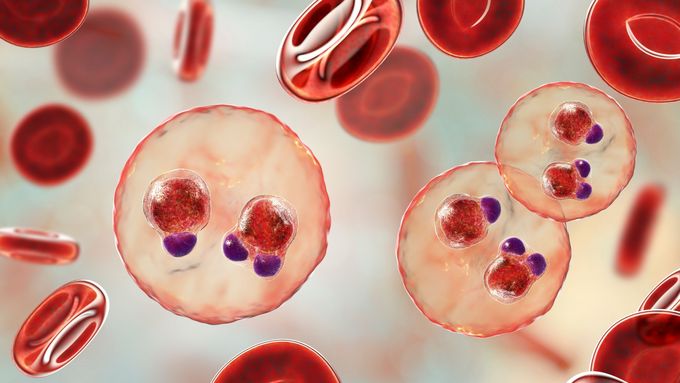 Malariainfizierte rote Blutkörperchen (Foto: AdobeStock)