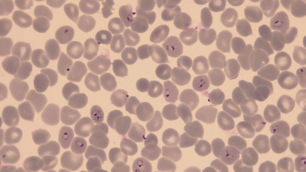 Red blood cells infected with P. falciparum (Photo: A. Passecker) Red blood cells infected with P. falciparum (Photo: A. Passecker)
