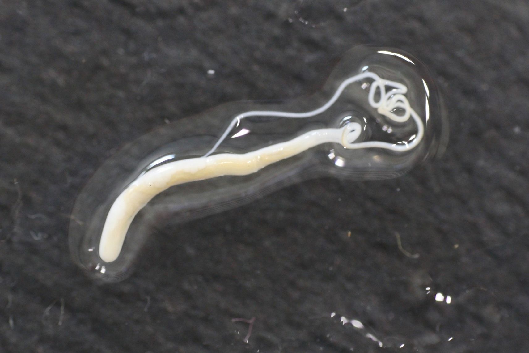 Trichuris trichiura adult (Photo: Y.Endriss/Swiss TPH)