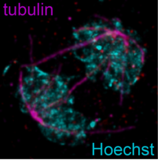 Ultrastructure expansion microscopy image of nuclear division in P. falciparum (Photo: Matthias Wyss)