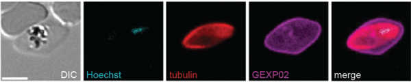Localisation of subpellicular microtubules and the exported protein GEXP02 in a stage III gametocyte. (Photo: Jheanell Johnson, MSc thesis 2025)