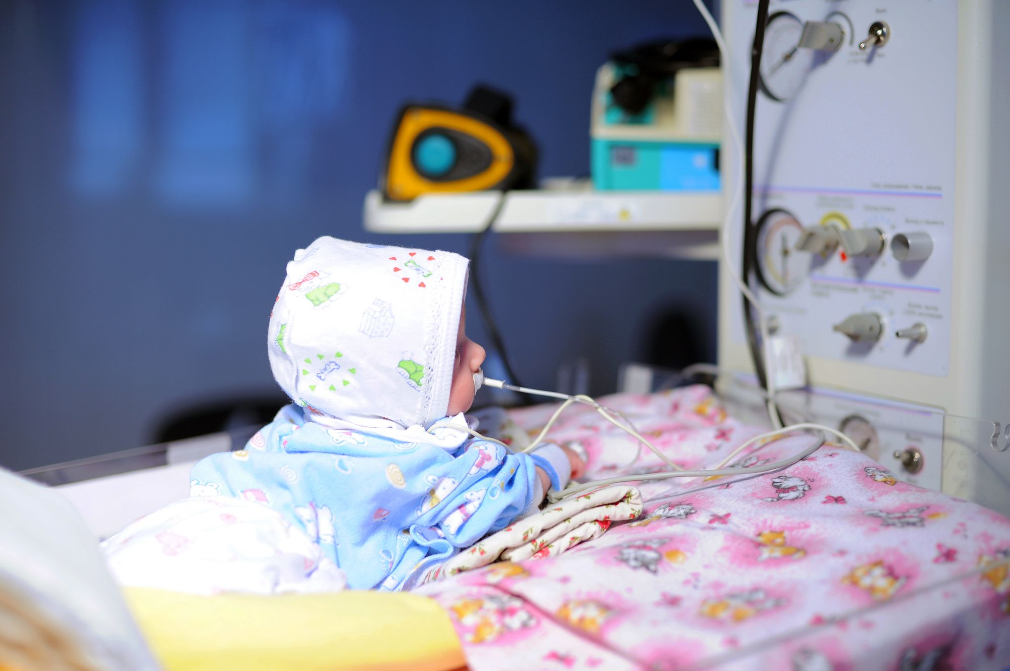 A newborn in care at a Moldovan neonatal unit. Two decades ago, many babies like her would not have survived their first weeks of life. Photo credit: Swiss TPH