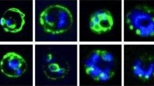 Malaria Host Interactions