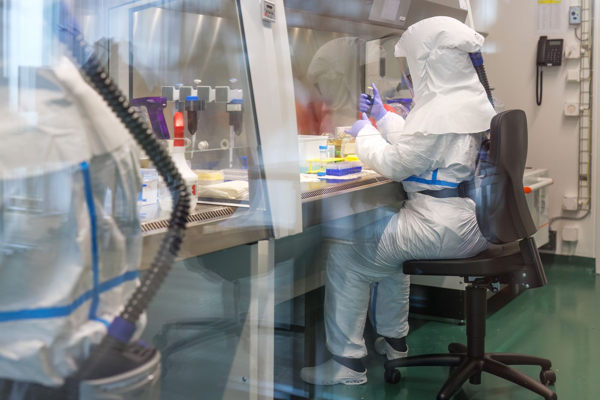 In Swiss TPH's BSL-3 laboratories, we are driving breakthroughs in drug resistance, diagnostics and drug development for tuberculosis, Chagas disease and Buruli ulcer.