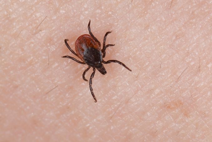 Holzbock Zecke (Ixodes ricinus) auf menschlicher Haut (Foto: AdobeStock)
