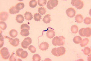 Urin würmer im Bilharziose (Schistosomiasis)