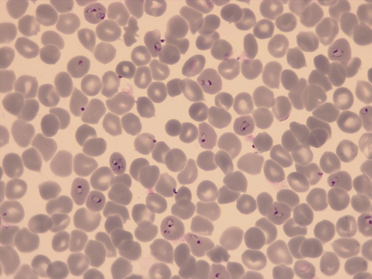 Red blood cells infected with P. falciparum (Photo: A. Passecker/Swiss TPH)
