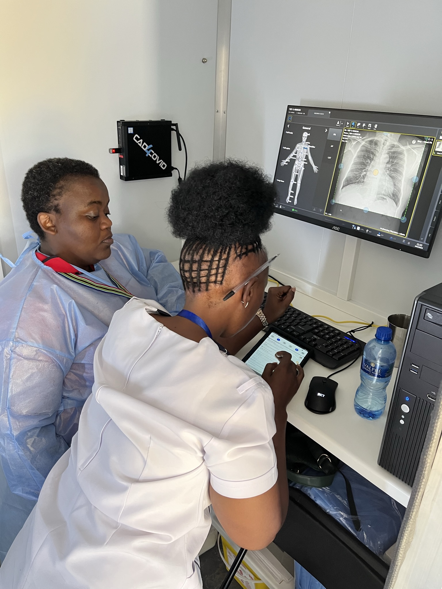 X-ray of a lung during a TB screening (Photo: Aita Signorell/Swiss TPH)