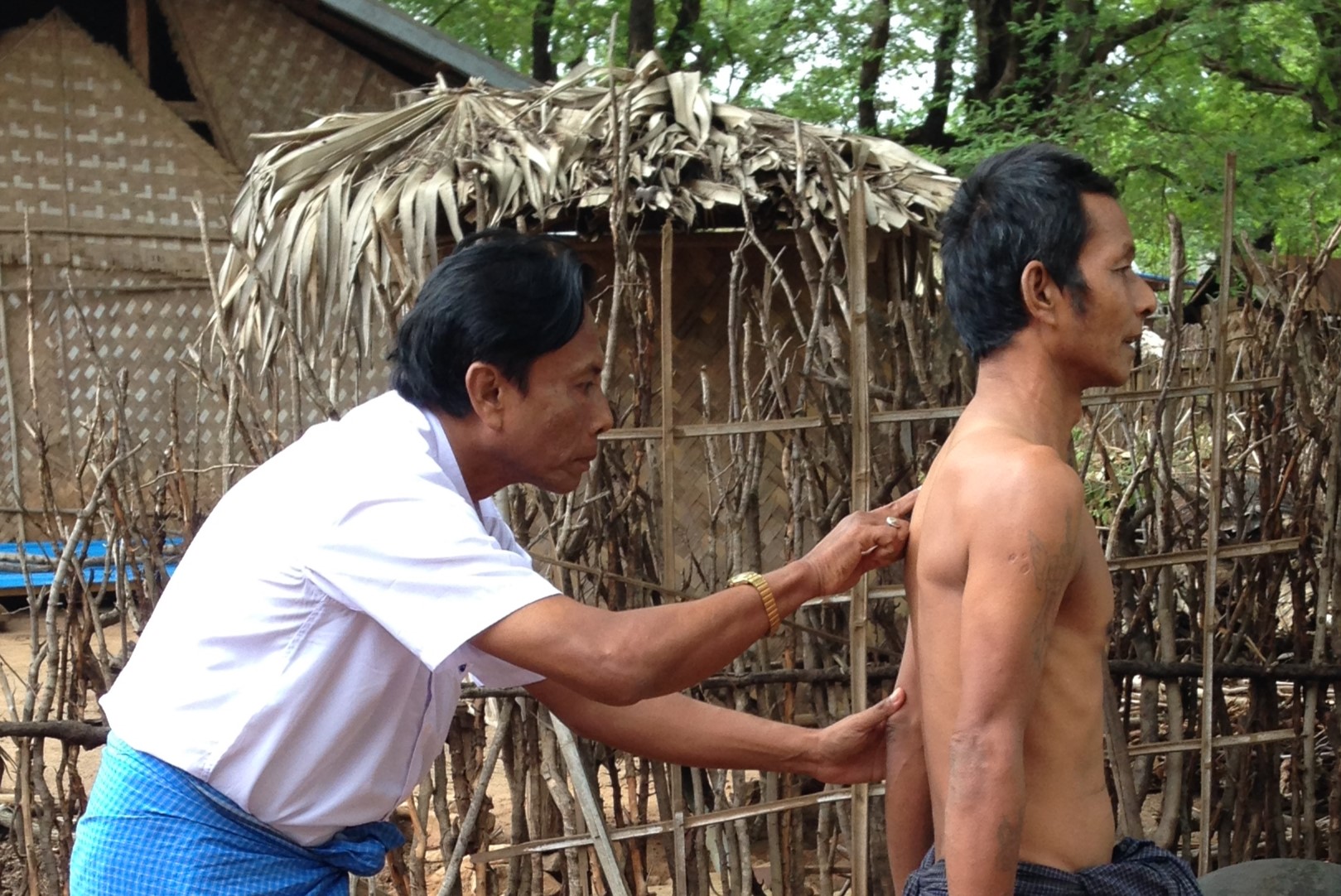 Leprosy screening in Myanmar (Photo: P. Steinmann/Swiss TPH)